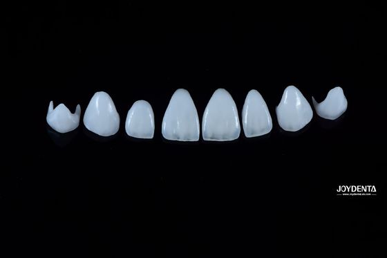 0.3-0.5mm épaisseur Porcelaine naturelle Émax Veneers haute résistance durable pour l'esthétique