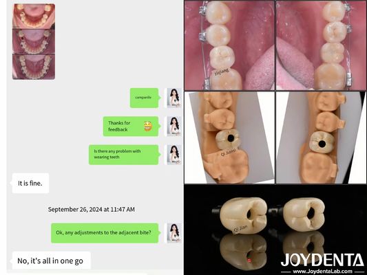 Implants dentaires à pleine voûte à longue durée de vie Longueur de l'implant endosseux 10 mm-16 mm