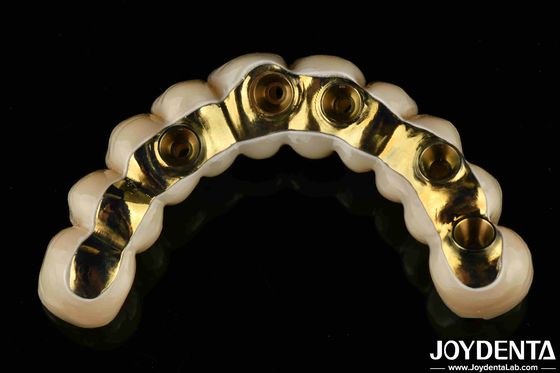 Prothèses dentaires sur mesure en zirconium hybride de pont de précision
