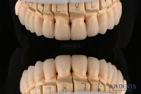 Zirconium dentaire à couches polies d'une épaisseur de 0,3-0,5 mm avec technologie CAD CAM
