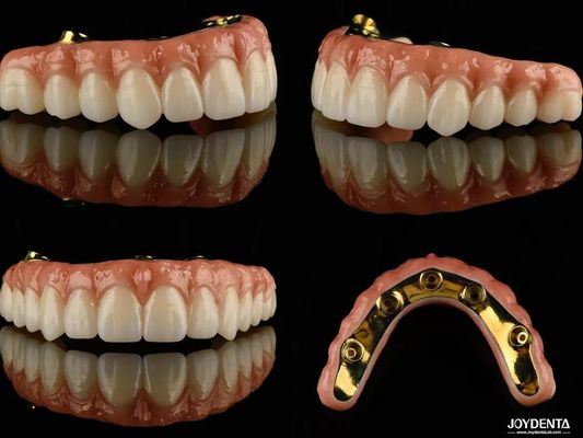 Des ponts hybrides d'implants en zirconium à haute translucide pour les prothèses dentaires