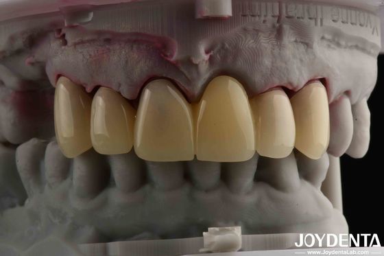 CAD CAM Processing Dental PMMA Material Multilayer Design Pour les transitions naturelles de l'ombre