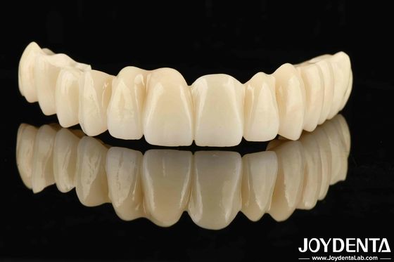 Conception multicouche de PMMA dentaire sans couture pour les transitions naturelles d'ombre