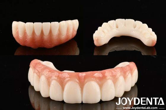 Dentiste à haute transparence PMMA M75 pour les restaurations esthétiques et résistantes aux rayures