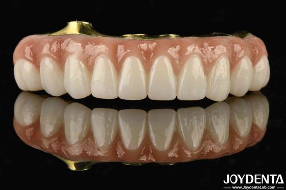 Titane et Zirconia Confort Confortable à porter Ti-Bar Zirconia pont hybride pour le remplacement des dents manquantes