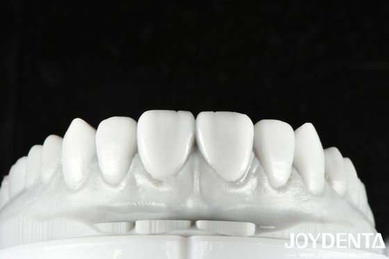 La cire dentaire de couleur naturelle est une solution polyvalente pour la restauration d'une ou plusieurs dents.