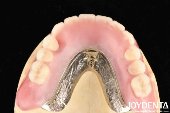 Connectez fermement la rangée des dents élaborez un cadre technologique de mise en place des dents de finition pour les professionnels dentaires et un résultat précis