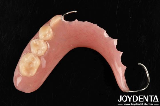 Élaborer une technologie pour une structure buccale stable cadre de mise en place des dents finition dans l'application dentaire