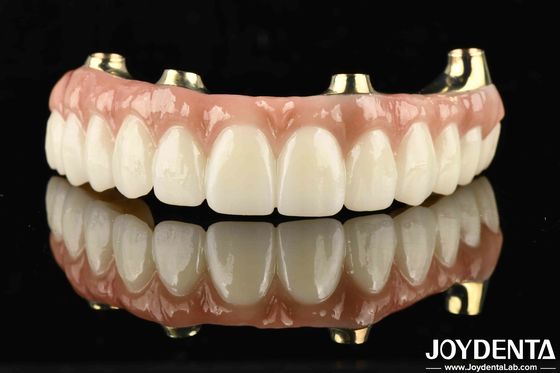 Fonctionnalité Le Ti-Bar compatible avec les dents et les gencives naturelles rétablit la fonction de mastication