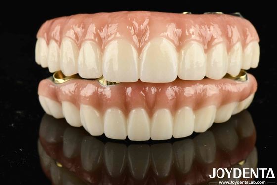 Pont hybride en zirconium en Ti-Bar de haute durabilité pour obtenir une esthétique
