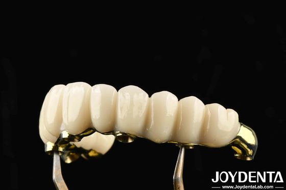 Confortable à porter, le pont hybride en zirconium à barres de Ti rétablit la fonction de mastication, compatible avec les dents et les gencives naturelles.