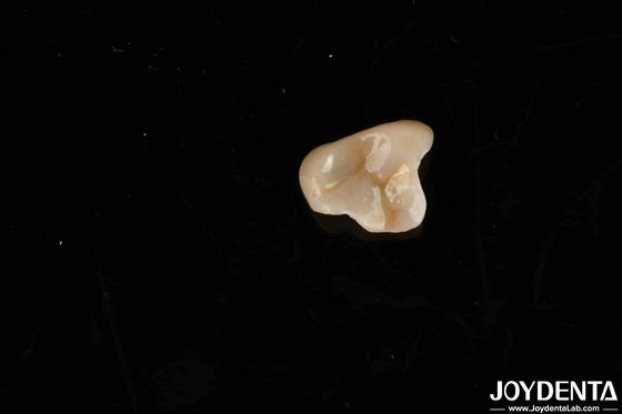 Matériau non toxique E-max Solution ultime Emax Inlay Onlay pour les normes de biocompatibilité