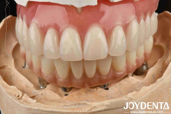 Bonne élasticité dentelle Prothèse dentaire acrylique Finition avec la technologie d'arrangement des dents