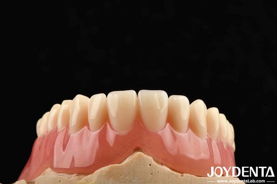 Finition de dentition acrylique de bonne élasticité pour une personnalisation personnalisée légère et un design personnalisé