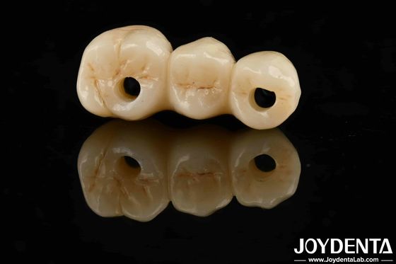 Haute esthétique Haute résistance à la flexion 1000 MPa Zirconium complet pour les normes