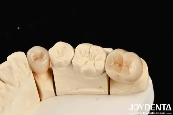 Excellente biocompatibilité: Zirconie complète avec une résistance élevée à la corrosion et une résistance à la flexion de 1000 MPa