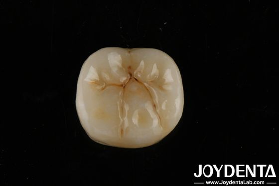 Circonia à haute translucide avec couches Biocompatibilité et résistance à la flexion de 800 MPa