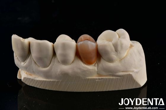 Biocompatible et naturel, couche de zirconie pleine esthétique