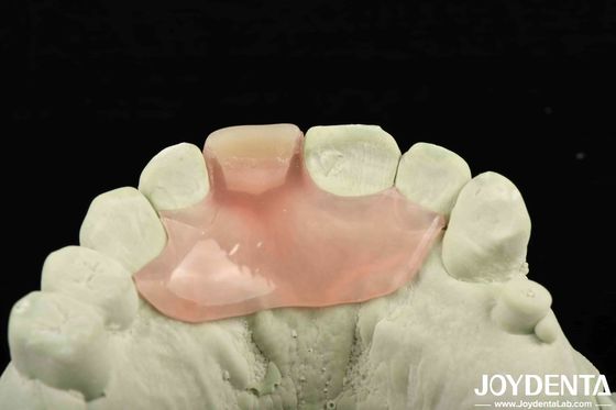 Personnalisation personnalisée Finition de prothèse flexible utilisant la technologie d'arrangement des dents avec une bonne élasticité