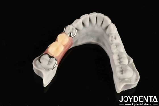 Structure orale stable pour les professionnels de la dentisterie en reliant fermement la rangée des dents
