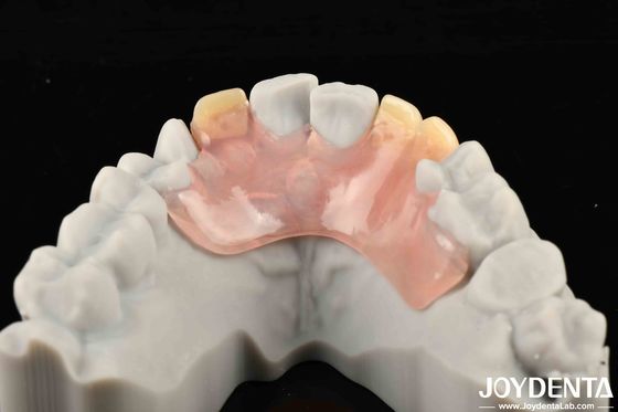 Structure orale stable cadre d'effet mettre en place les dents finition belle et harmonieuse conception de l'apparence