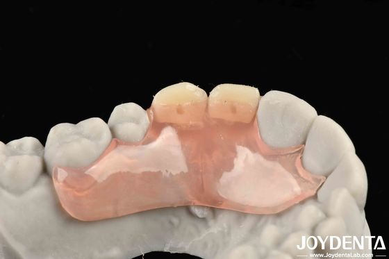 Un cadre de conception de l'apparence belle et harmonieuse pour la mise en place des dents finition technologie élaborée pour une structure orale stable