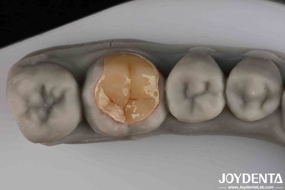 Résistant à l'usure et à la déchirure Bonne transparence Faible résistance Emax Inlay Onlay Pour votre efficacité opérationnelle