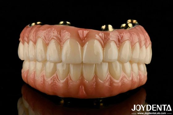 Des dents et des gencives naturelles compatibles avec le pont hybride en zirconium en Ti-Bar avec une haute biocompatibilité