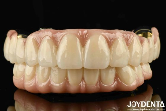 Excellente résistance à l'usure, pont hybride en zirconium pour les dents et les gencives naturelles