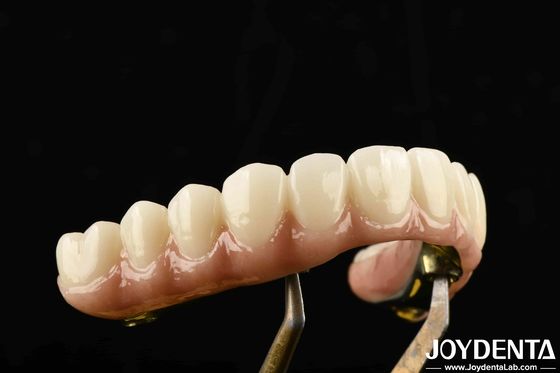 Un pont hybride en zirconium à barres de ti-bar durable, en titane et en zirconium, destiné aux véhicules lourds.