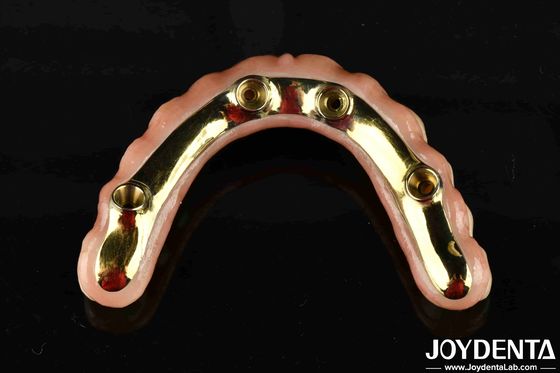 Confortable à porter Ti-Bar rétablit la fonction de mastication essentiel Ti-Bar Zirconia pont hybride pour les transactions B2B