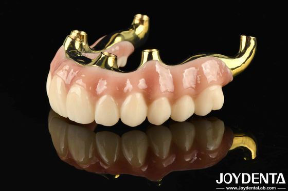 Restauration de la fonction de mastication du pont hybride en zirconium en Ti-Bar avec une haute biocompatibilité et un ajustement précis