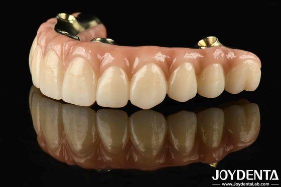 Pont hybride en zirconium en bar en Ti, résistant à la corrosion et à l'usure, restaurant la fonction de mastication avec précision