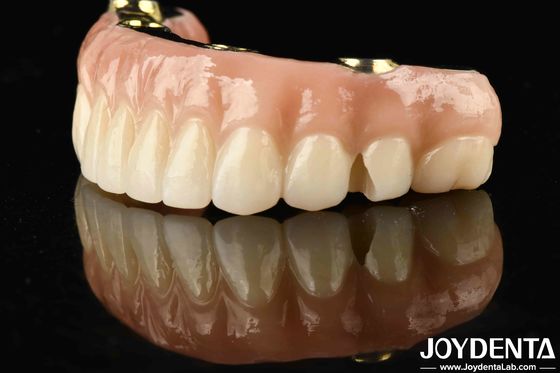 Transformez votre restauration dentaire avec un pont hybride en zirconium durable et durable