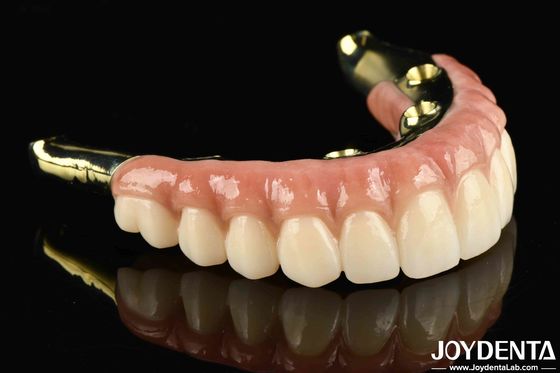 Dites au revoir aux dents manquantes avec de la zirconium naturelle et durable