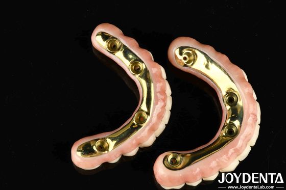 Ponte hybride en zirconium à l'aspect naturel avec une grande durabilité et une biocompatibilité