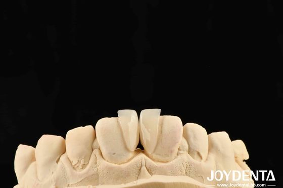 Micro-plaquette de haute durabilité d'épaisseur de 0,2 mm et performances fiables