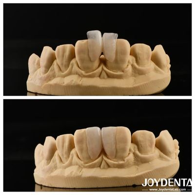 Facile à installer Micro Veneer Solution ultime pour la décoration intérieure Épaisseur 0,2 mm