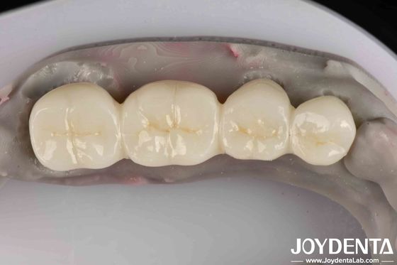 Excellent produit blanc en zirconium complet avec une grande résistance à la corrosion