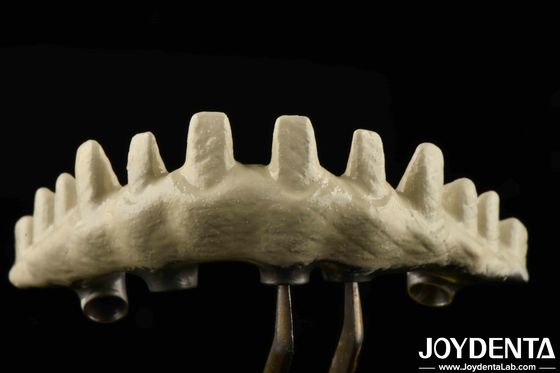 Type de connexion hexagonale interne Abutments d'implants personnalisés sablé et gravé à l'acide pour un ajustement supérieur