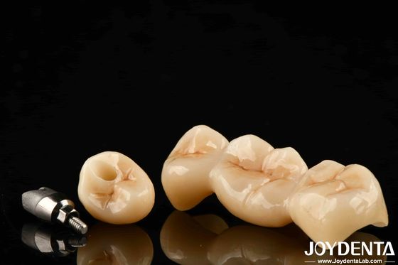 Plusieurs couches de zirconium complet haute résistance aux fissures et durabilité pour les restaurations dentaires durables