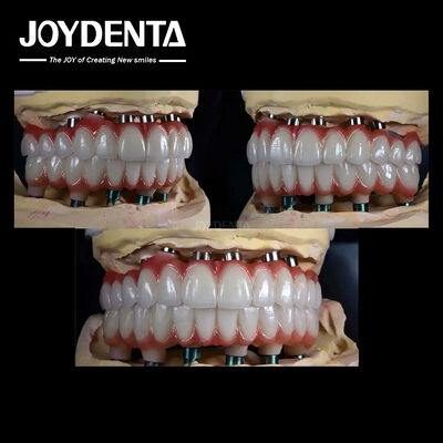 Implantation dentaire multiple en titane de 10 mm Surface rugueuse pour la restauration dentaire