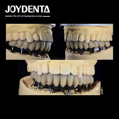 Titane implant dentaire à dents multiples chirurgie prothétique connexion hexagonale externe