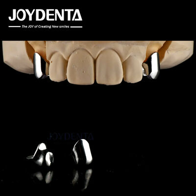 Prothèse amovible de précision Implants dentaires