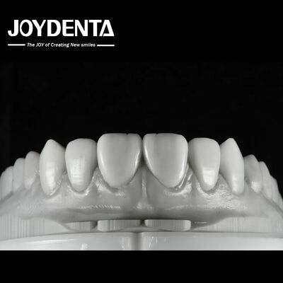 La cire dentaire de couleur naturelle est une solution polyvalente pour la restauration d'une ou plusieurs dents.