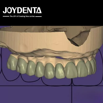 Conception personnalisée, diagnostic numérique et intégration transparente du logiciel