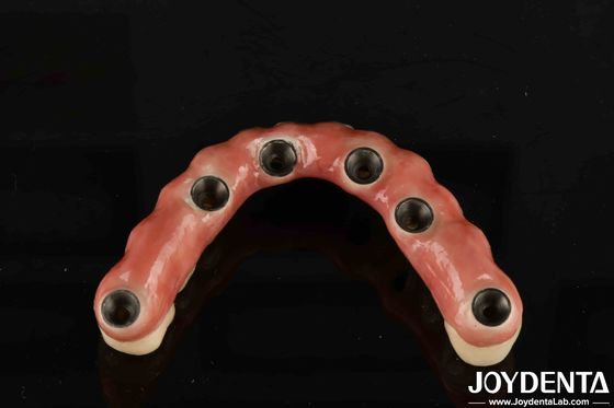 Nom