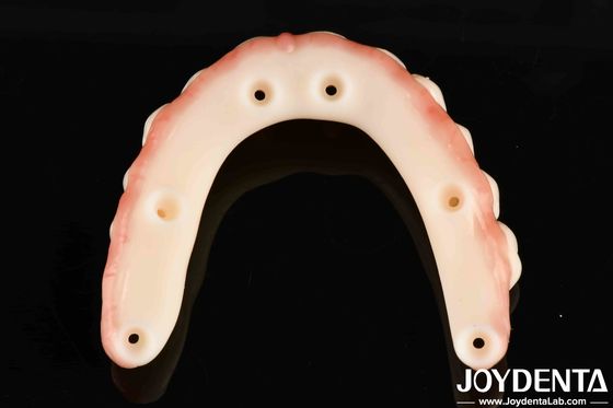 Nom